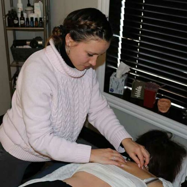 acupuncture therapy