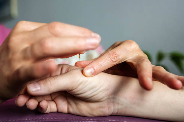 Hand acupuncture near me