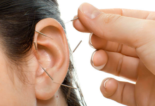 Acupuncture ear points near me